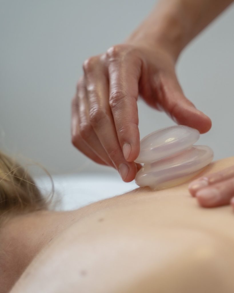 Cupping Massage op de rug